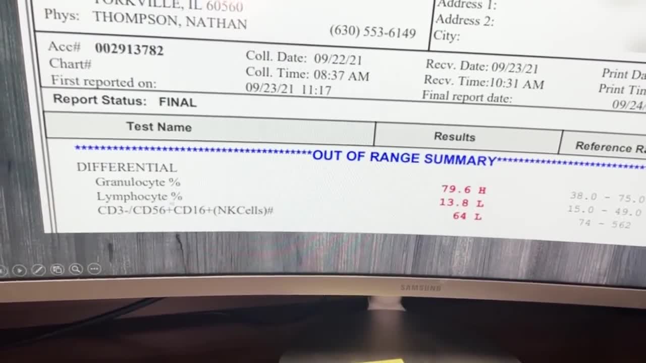 My Jaw DROPPED when I Tested Someone's Immune System After the 2nd Jab
