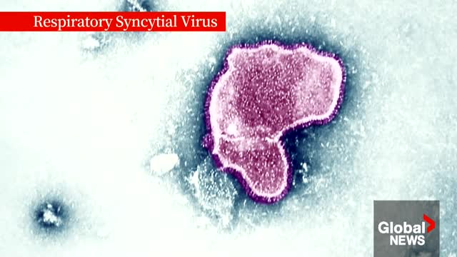 Flu vs RSV How to tell the difference between viral respiratory infections