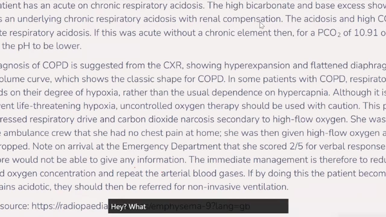 MRCP II Pastest Respiratory 1