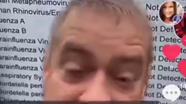 CORONAVIRUS 229E IS THE COMMON COLD