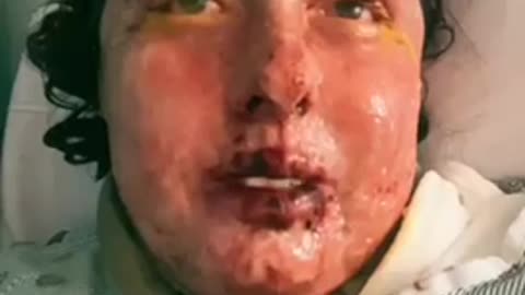 🥲 She took the jab look what happened