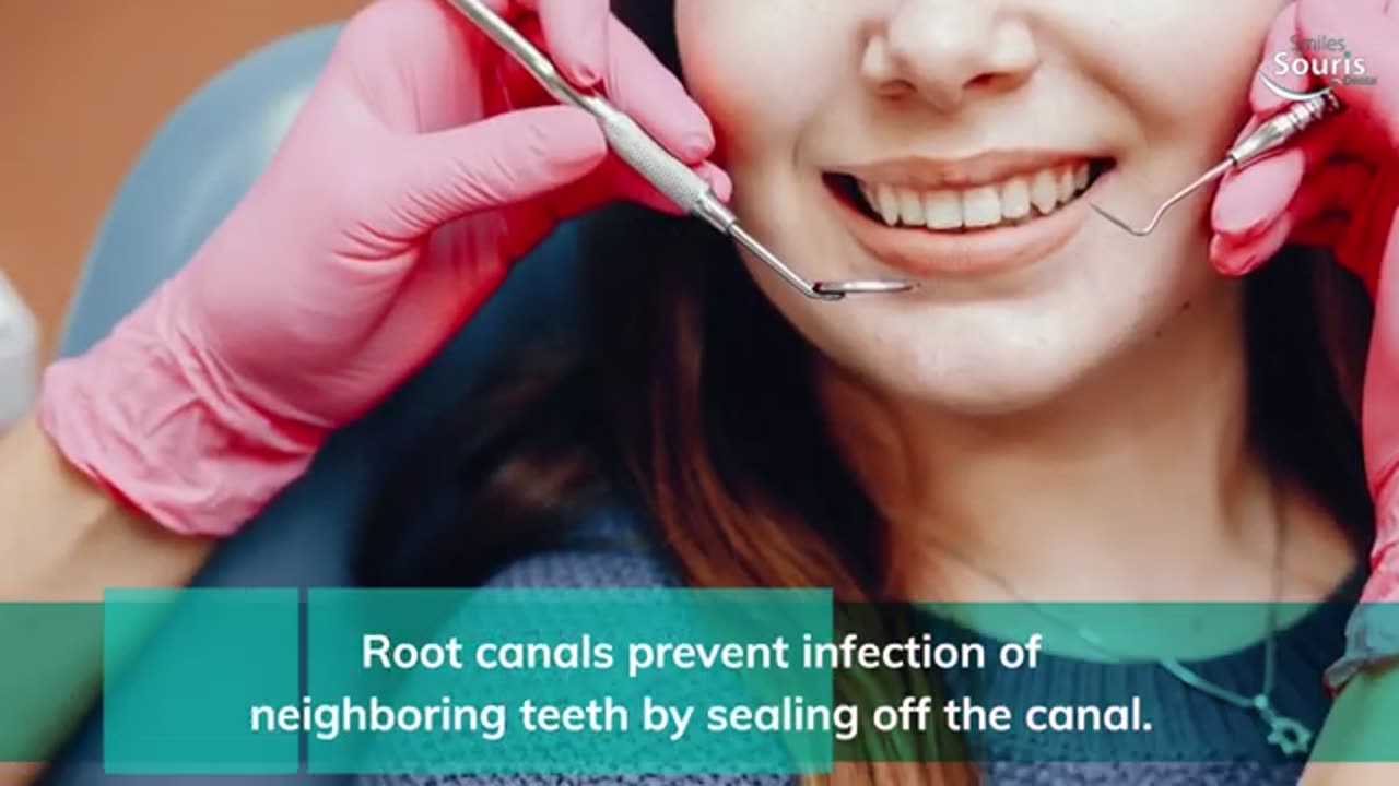 Discover the Benefits of Root Canal Treatment at Smiles On Souris