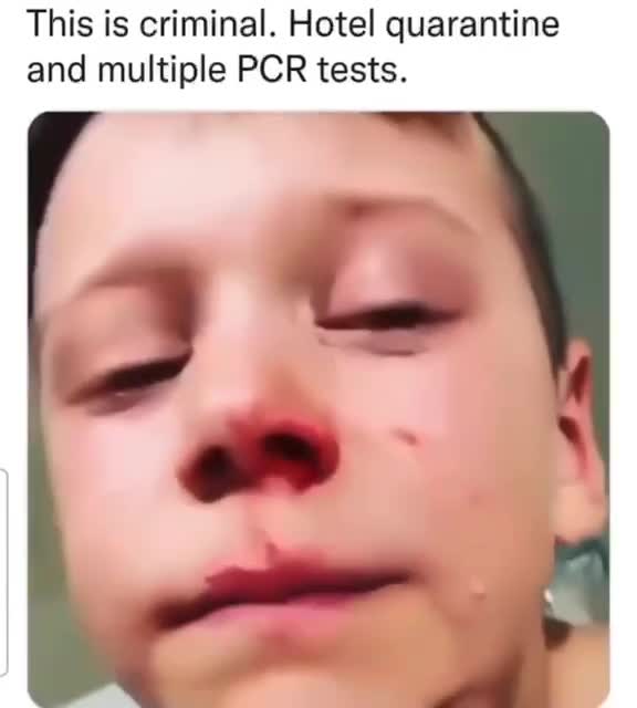 So you didn't know what a PCR test is