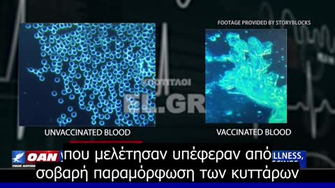 Οι εμβολιασμένοι εκδηλώνουν νέα νοσήματα. Γιατροί καταγράφουν ξένα συστατικά μέσα στα εμβόλια