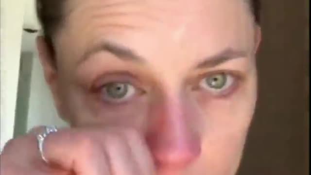 Canadian actress Jennifer Gibson developed Bell's palsy two weeks after receiving the AstraZeneca