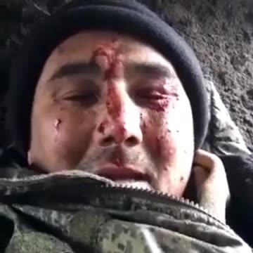 Russian soldier, who lost a leg during fighting