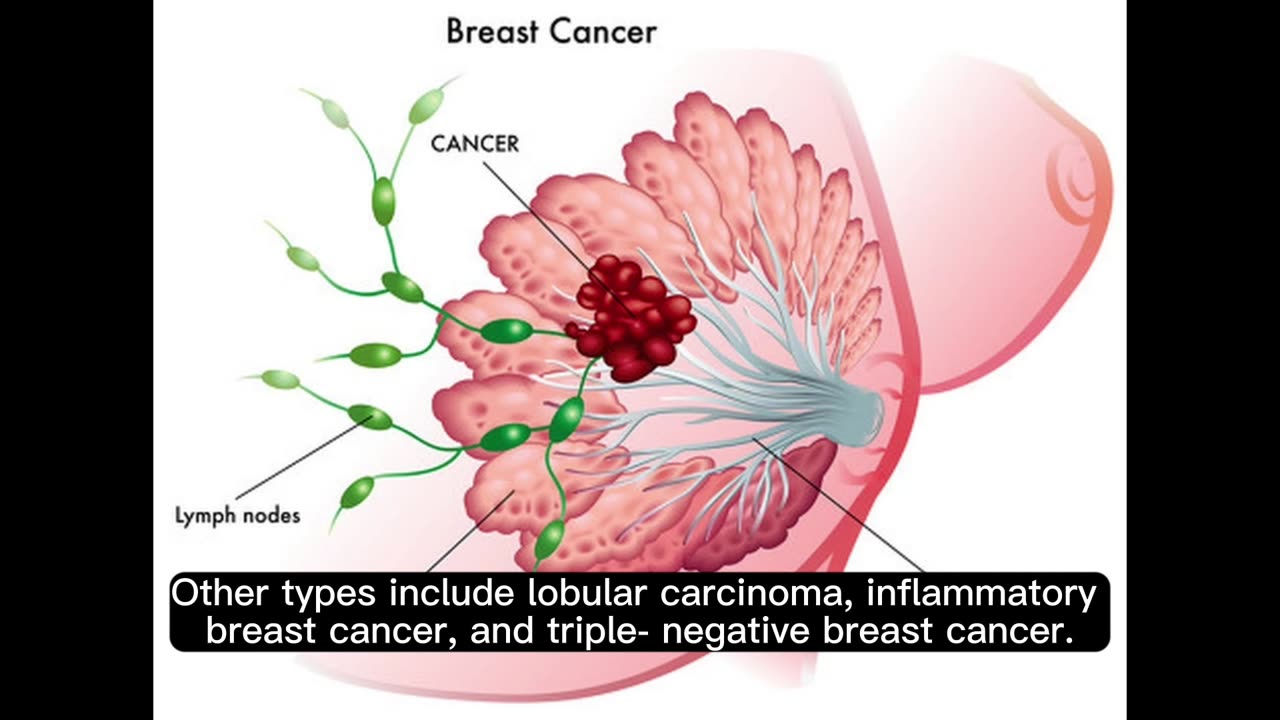 breast cancer, its causes, symptoms, and treatment #breastcancer #care #health #awareness #foryou