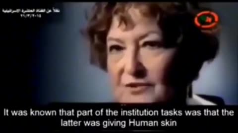 Israel human skin bank