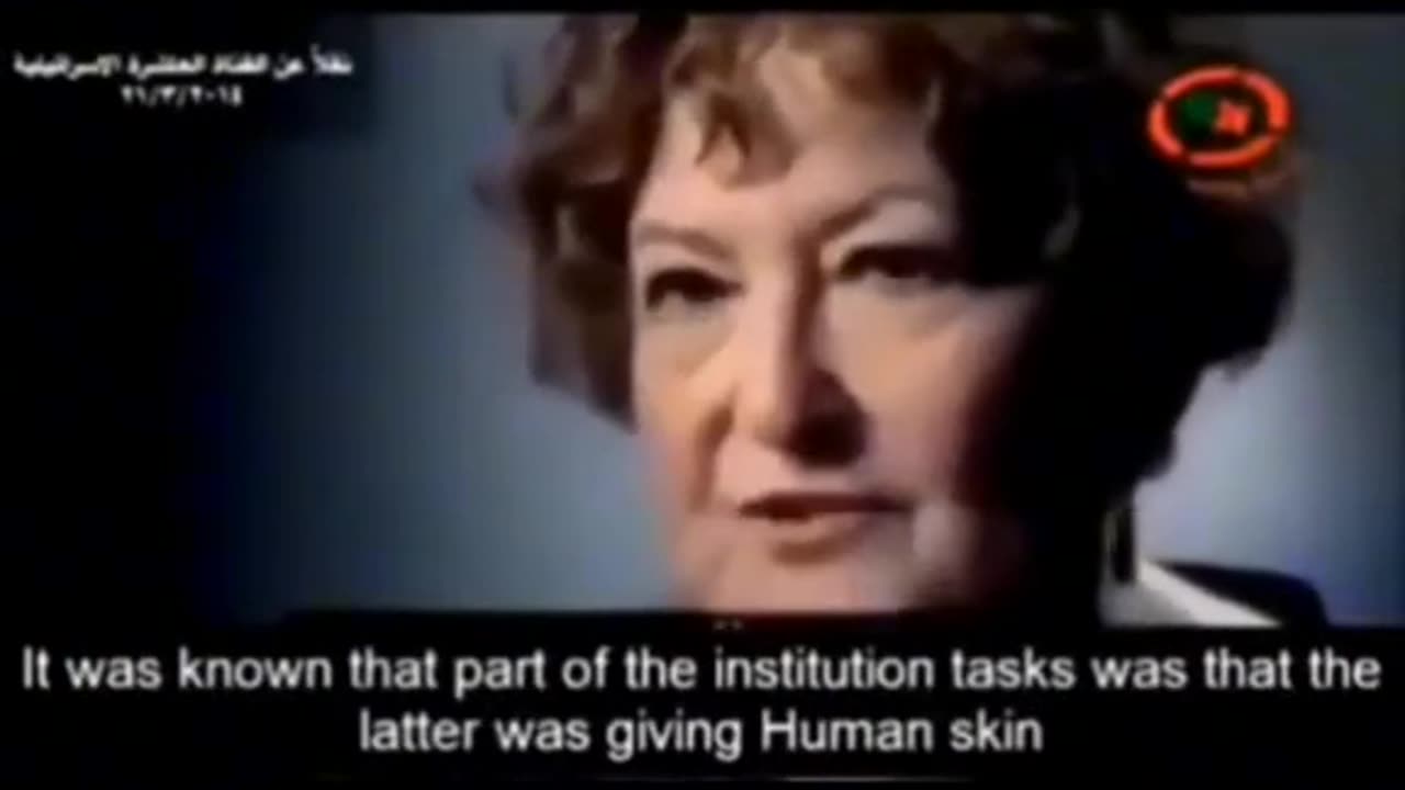 Israel human skin bank