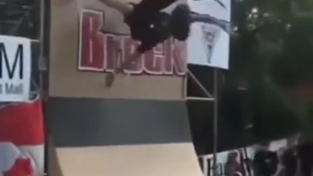 It hurts