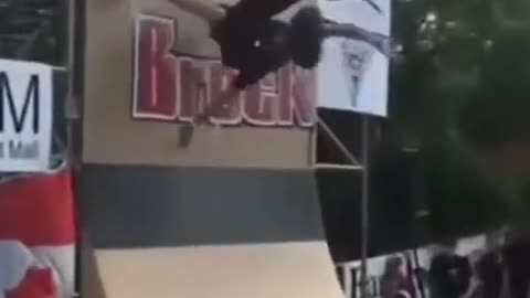 It hurts