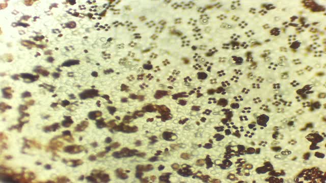 LBM spores