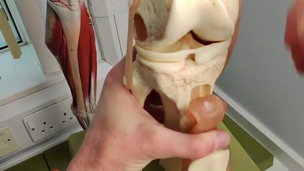 What is the Meniscus of the Knee Joint #anatomy