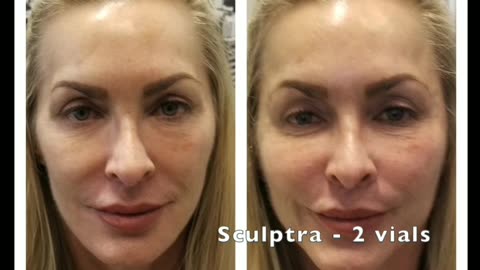 Las Vegas Aesthetics Medical Spa Intro Video
