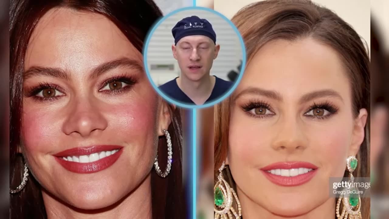 Sofia Vergara new face plastic Surgery Analysis