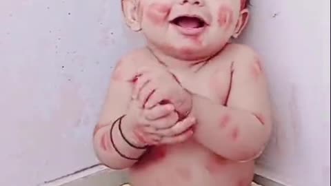 Happy kiss day😘 || funny baby || baby video💋