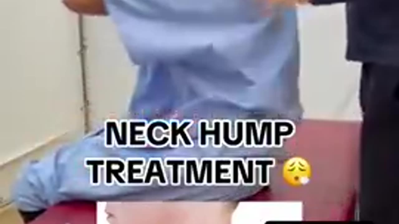 IF THIS IS THE TREATMENT TO FIX THE "HUMP"...I WOULD RATHER KEEP MY HUMP.