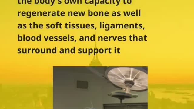 What is limb lengthening surgery