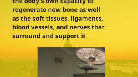 What is limb lengthening surgery