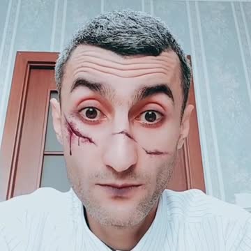 I can not open my mouth