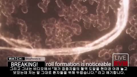 [STEW PETERS SHOW] 스튜피터_닥터 제인 루비(DR JANE RUBY)_백신 기생충