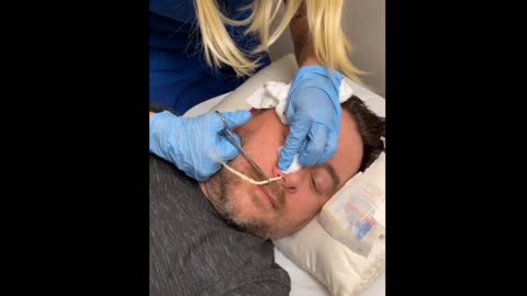 Tapeworm remove from the patient nose