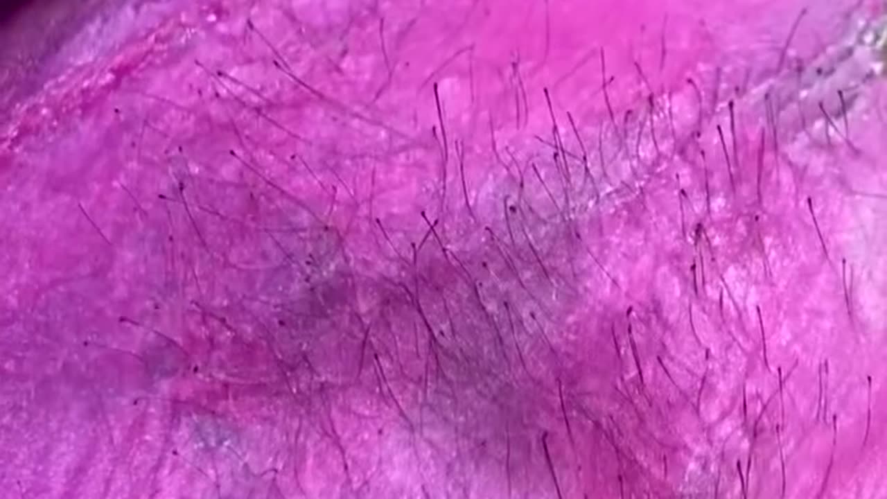 Underarm Waxing with Tickled Pink Hard Wax by Sexy Smooth Wax | Skin Boss