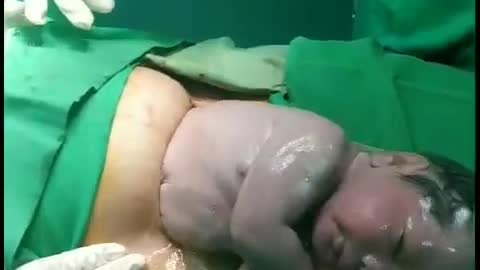 Baby's birth