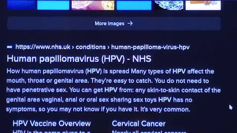 #nhs, #hpv, #vaccine, #sterilisation,