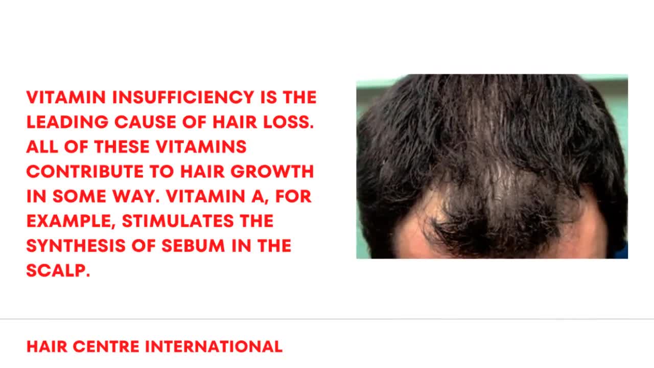 Hair Loss Solutions in Melbourne- HC International