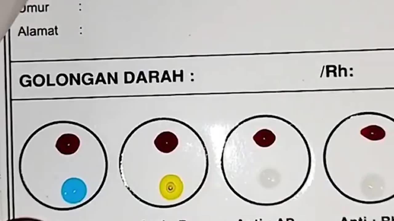 Have You Ever Wondered How A Blood Type Test Is Done⁉️