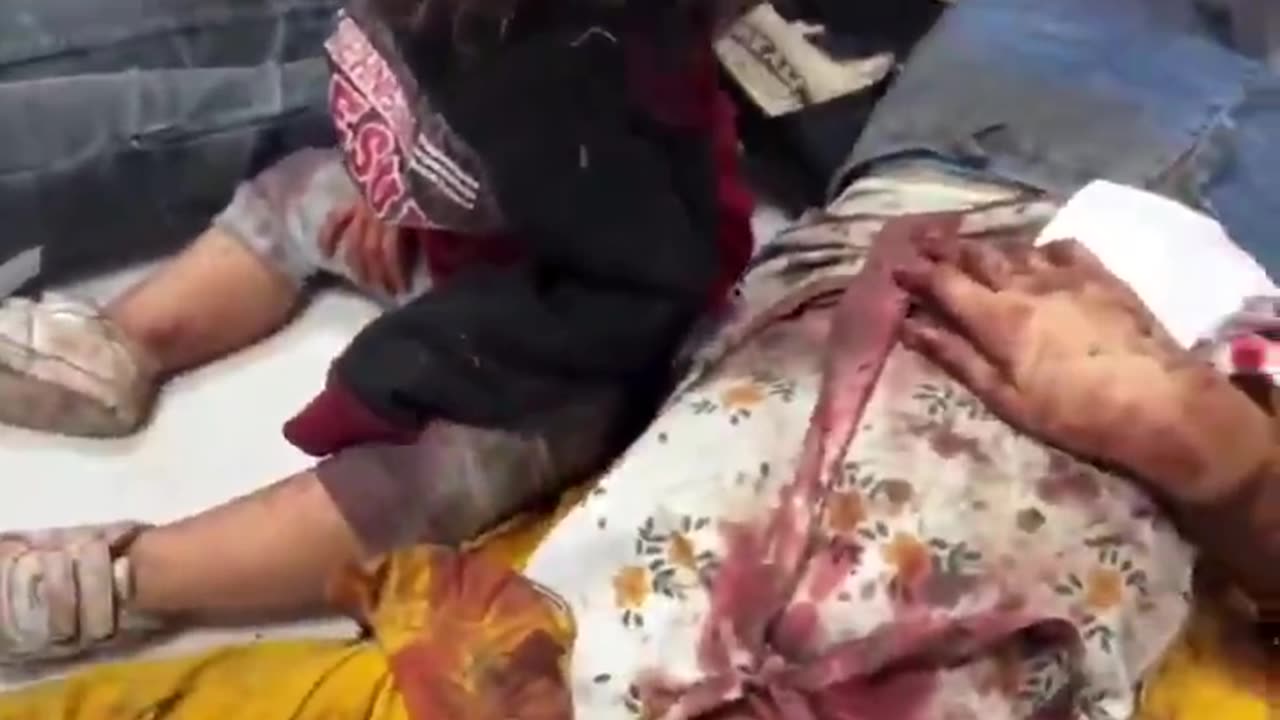 Footage of survivors of an Israeli strike on a hospital in Gaza.