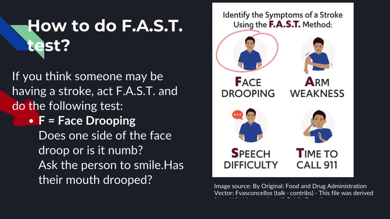 Recognizing Stroke Symptoms with FAST: Face, Arms, Speech, and Time | Quick Response Guide