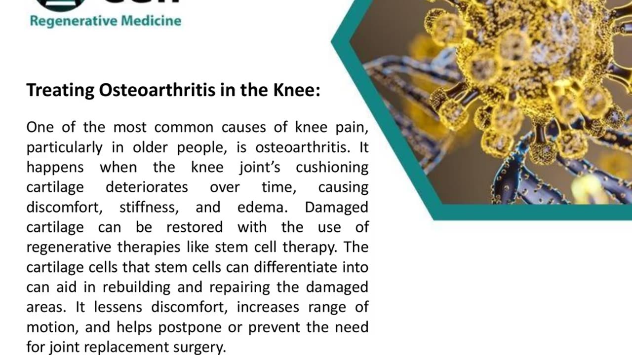 How Regenerative Medicine Can Help People With Knee Pain