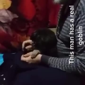 Iranian Man has A Gnome