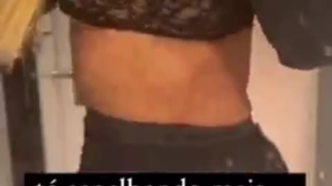 Horrific Covid Booster Injury - Her Days Of Being An Influencer Are Over 💉