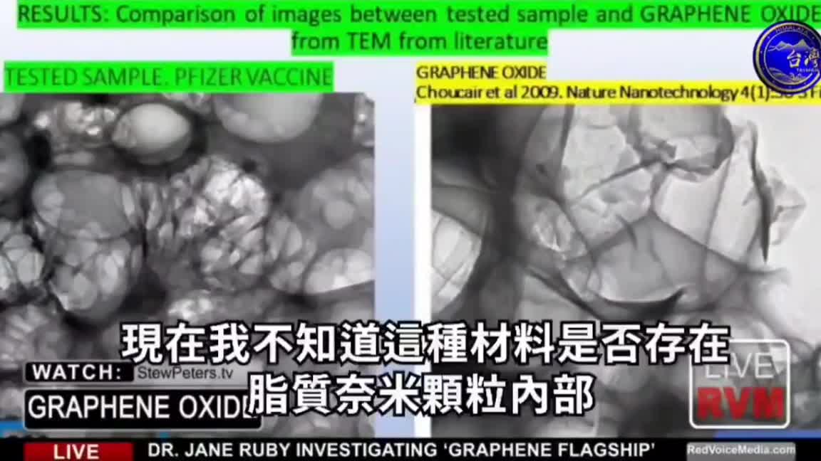 電子顯微鏡底下發現新冠疫苗裡有 劇毒的氧化石墨烯