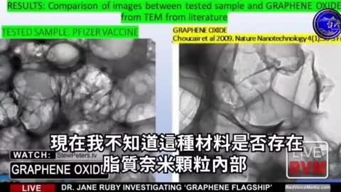 電子顯微鏡底下發現新冠疫苗裡有 劇毒的氧化石墨烯