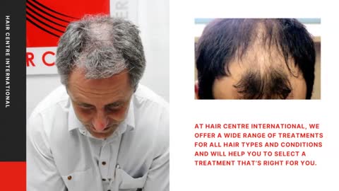 Hair Replacement in Melbourne- HC International