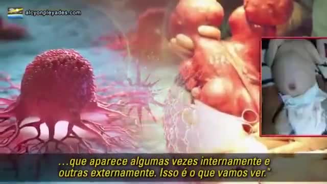 Dr. Mike Adams informa que a proteina spike das vacinas danificam o dna