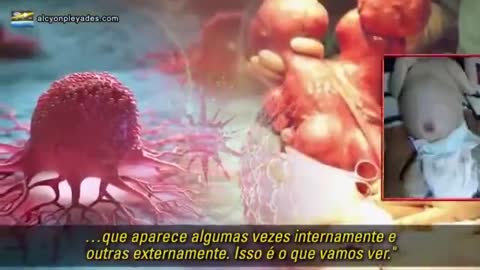 Dr. Mike Adams informa que a proteina spike das vacinas danificam o dna