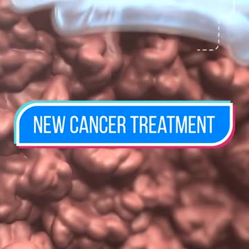 New cancer treatment has been approved