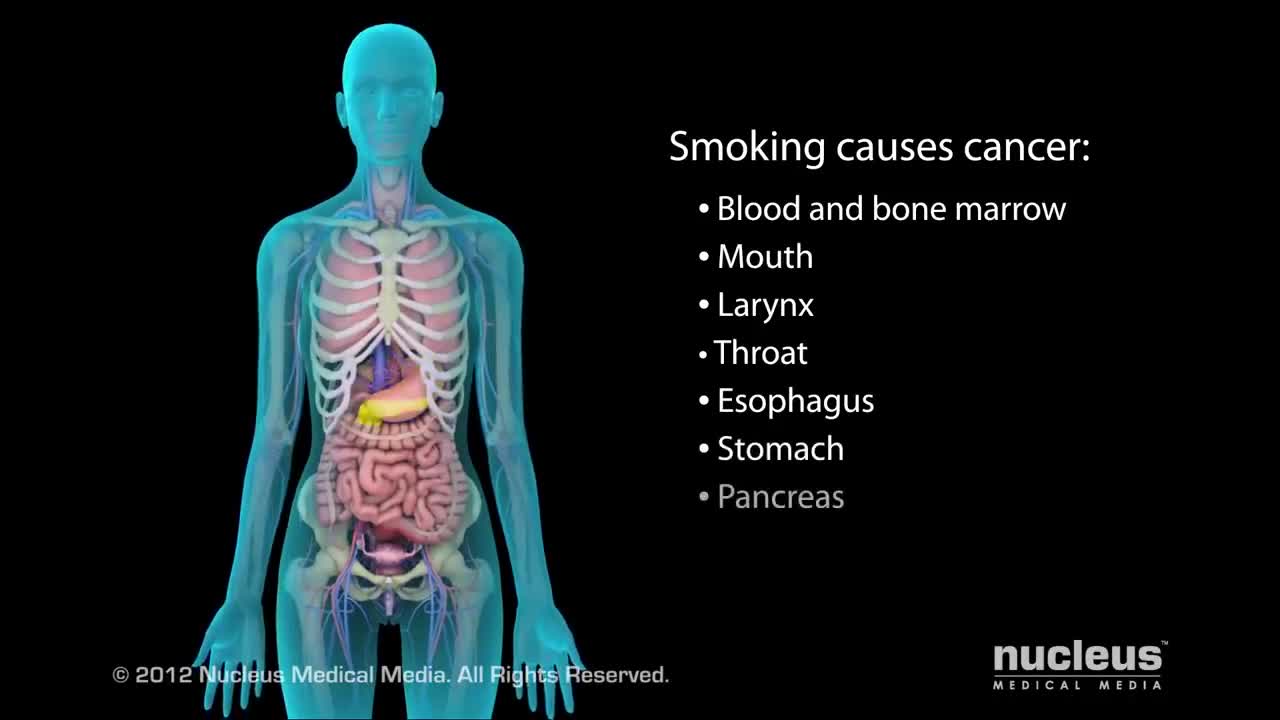 How Smoking Kills