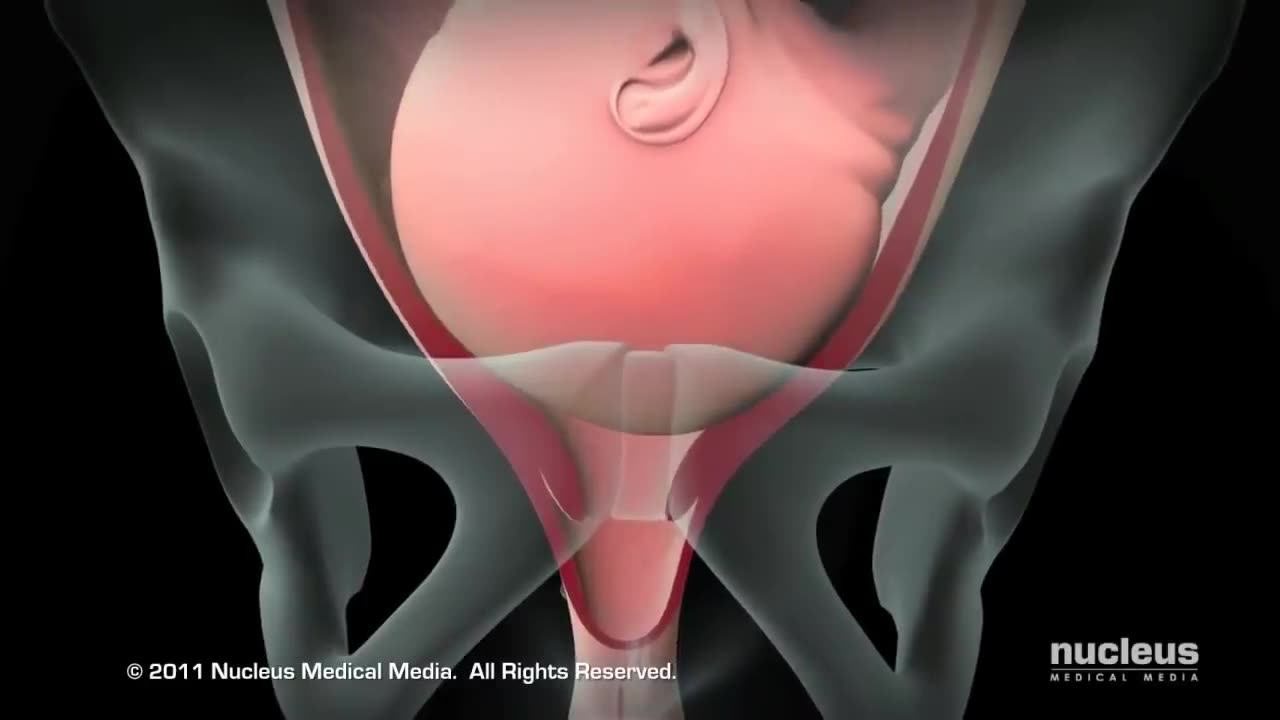 Vaginal Normal Doğum