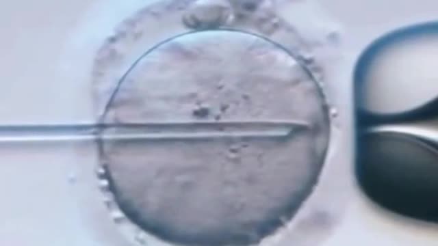 Intrafottcular single sperm injection