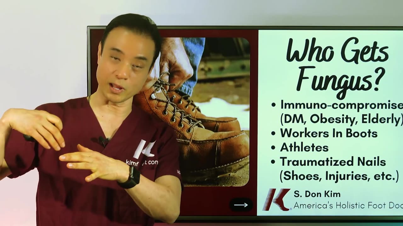 4 SYMPTOMS OF FOOT FUNGUS! | Holistic Toenail Fungus Cures Part 1 | Dr. Kim, Holistic Foot Doctor