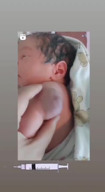 Risposta del vaccinculato: