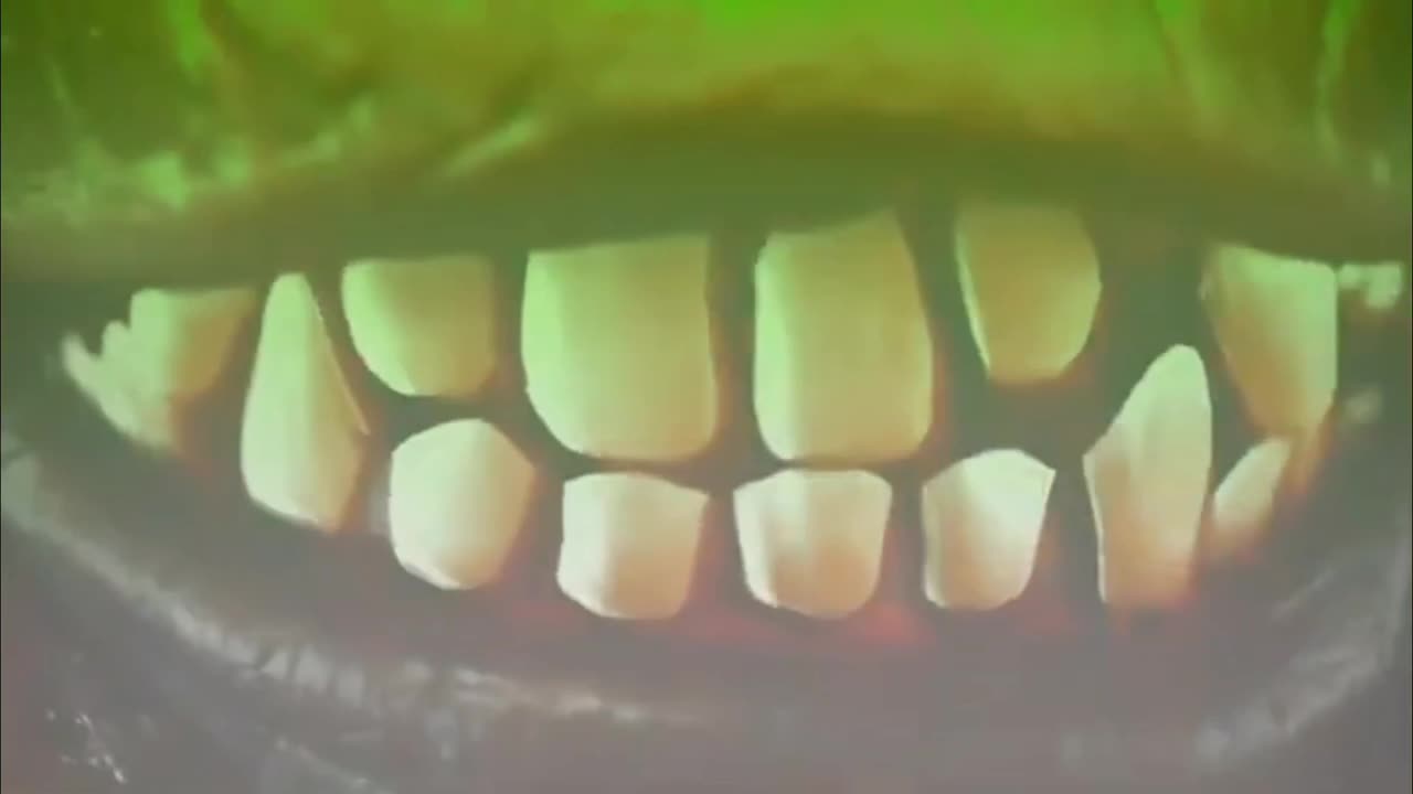 I just got my teeth clean