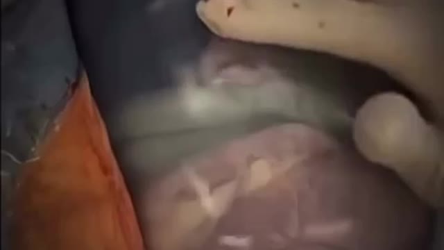 💖the miracle of birth, life and one’s first breath.