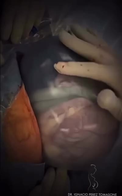 💖the miracle of birth, life and one’s first breath.